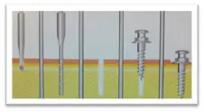Micro-implantes autorroscantes (self-tapping)