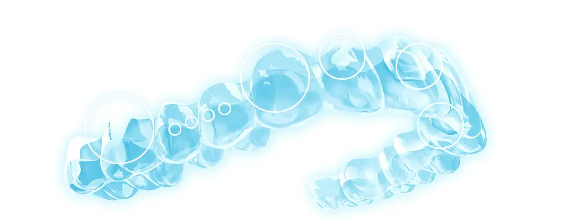 Invisalign® vs Spark™: comparativa de alineadores