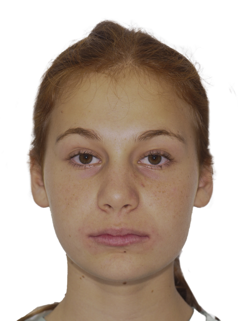 Figura 39 Foto Frontal Reposo