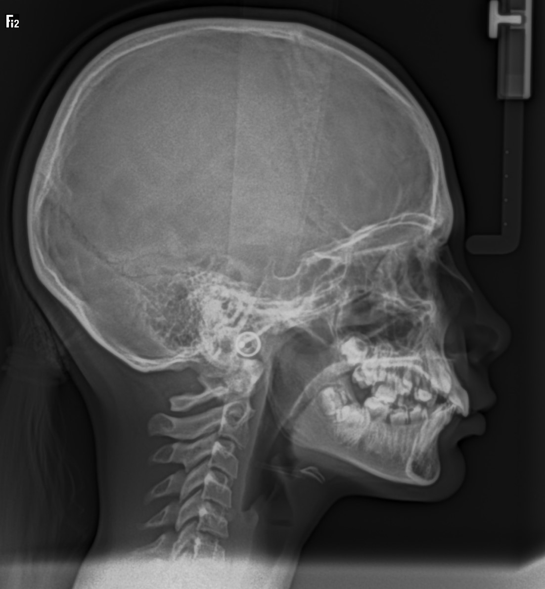 Figura 9 Telerradiografía
