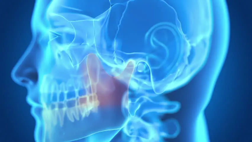 Rehabilitación Neuro-Oclusal